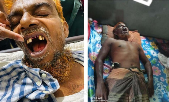 ভান্ডারিয়ায় জমি নিয়ে বিরোধের জেরে হামলার অভিযোগ, গ্রেপ্তার ১